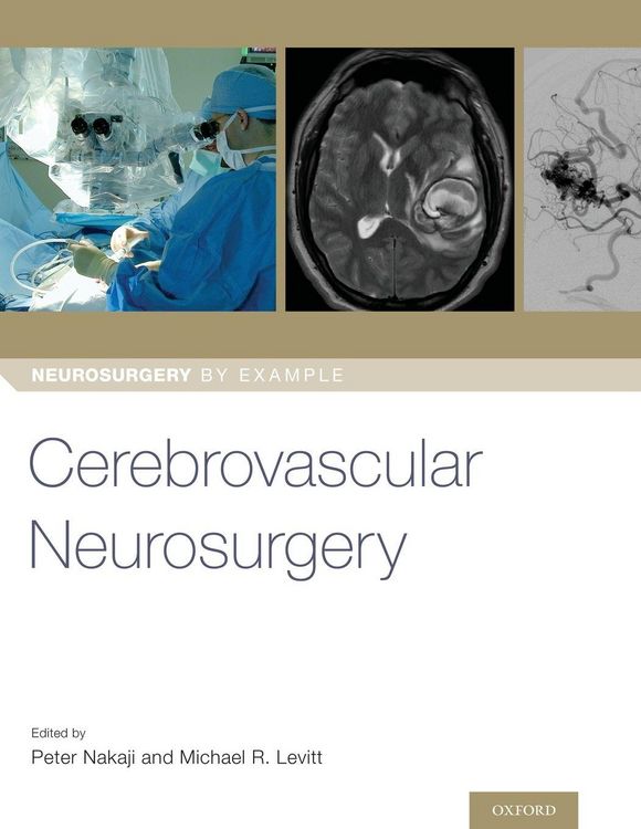 Produktbild: Cerebrovascular Neurosurgery