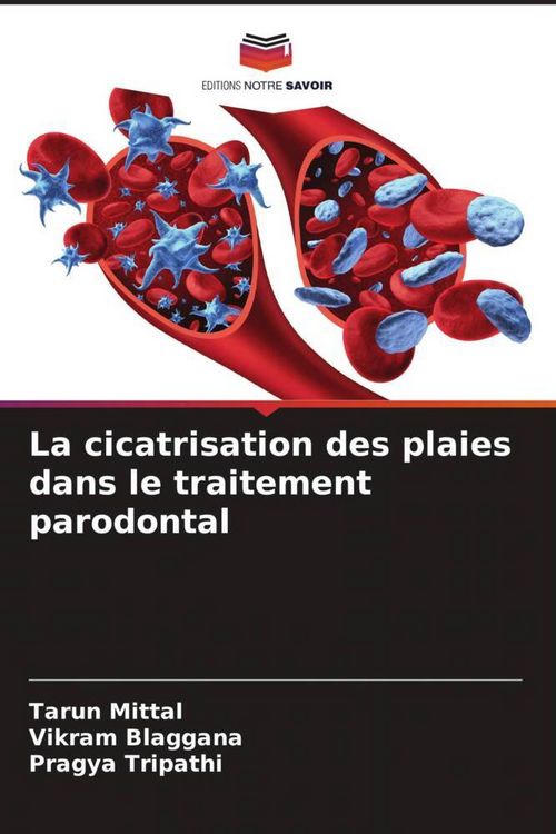 Produktbild: La cicatrisation des plaies dans le traitement parodontal