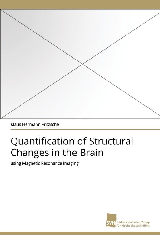 Produktbild: Quantification of Structural Changes in the Brain