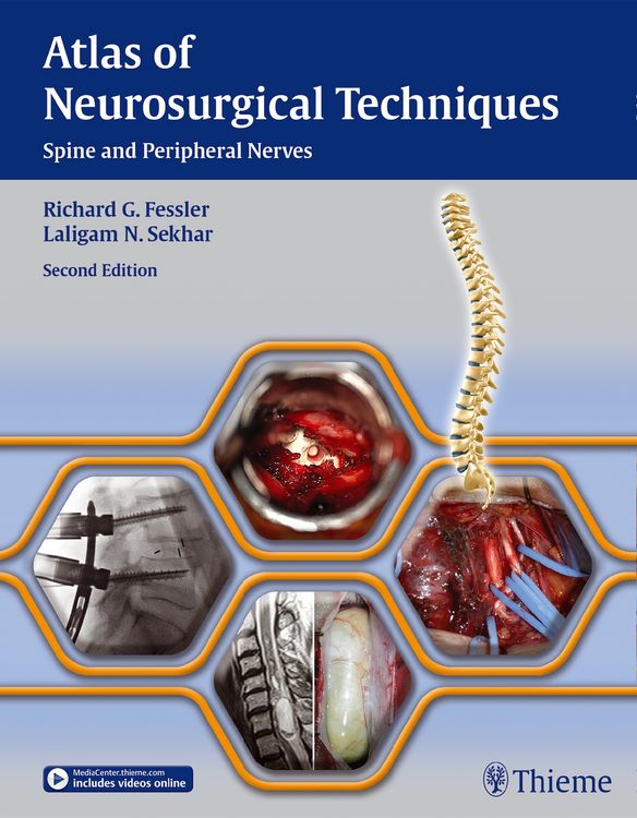 Produktbild: Atlas of Neurosurgical Techniques