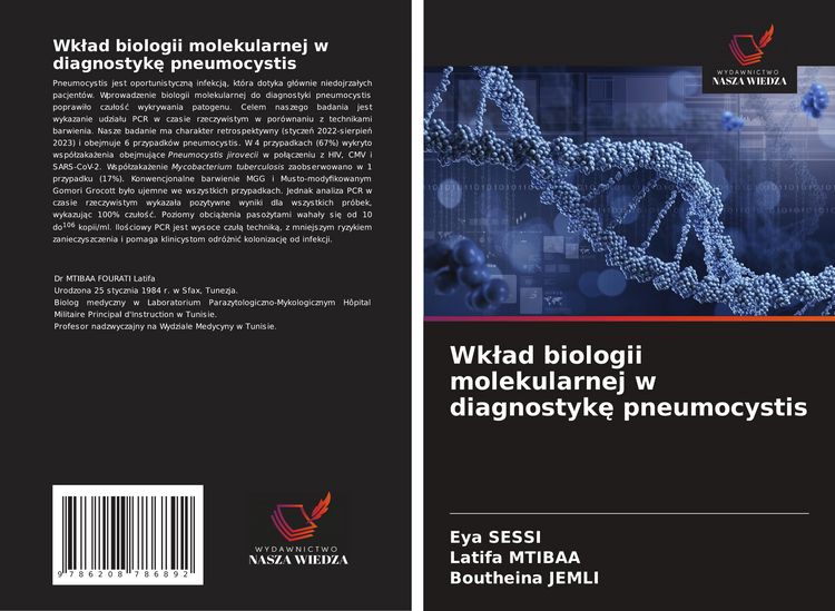 Produktbild: Wk&iquest;ad biologii molekularnej w diagnostyk&iquest; pneumocystis