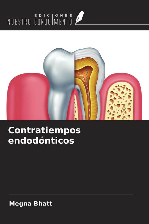 Produktbild: Contratiempos endod&oacute;nticos