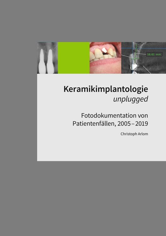 Produktbild: Keramikimplantologie unplugged
