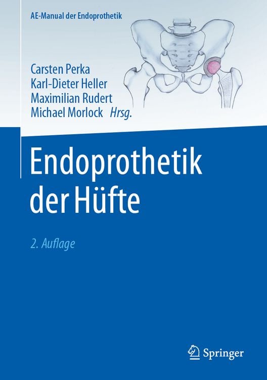 Produktbild: Endoprothetik der Hüfte