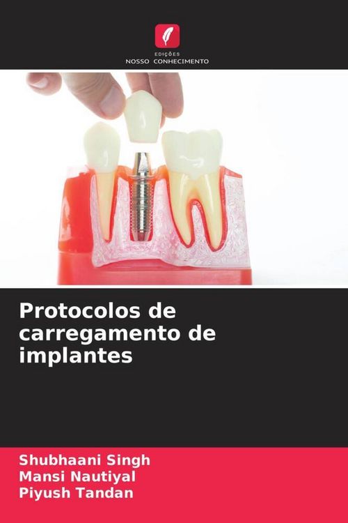 Produktbild: Protocolos de carregamento de implantes