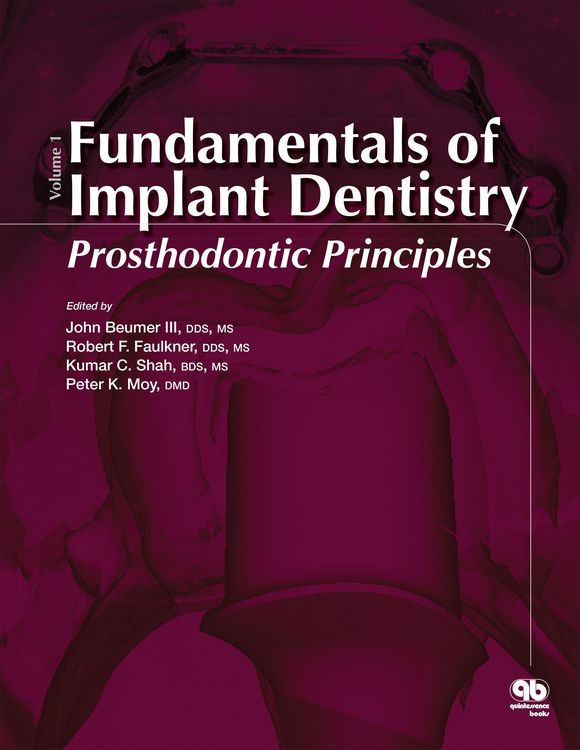 Produktbild: Fundamentals of Implant Dentistry, Volume 1
