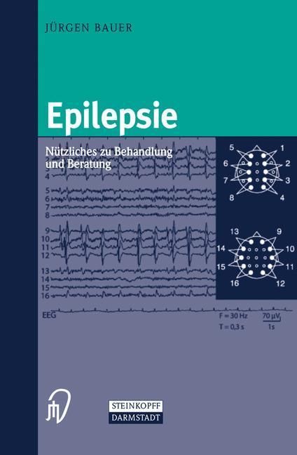 Produktbild: Epilepsie