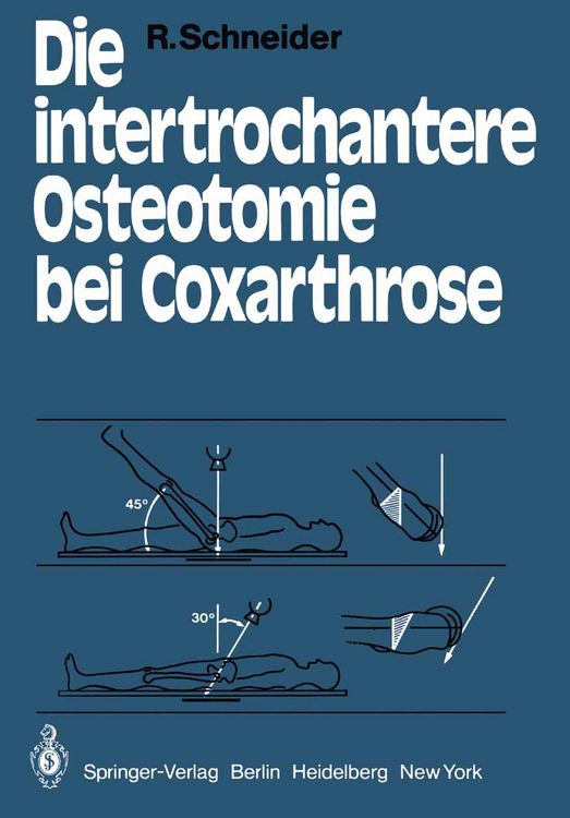 Produktbild: Die intertrochantere Osteotomie bei Coxarthrose