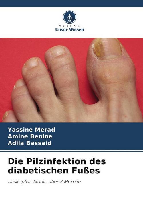 Produktbild: Die Pilzinfektion des diabetischen Fu&szlig;es