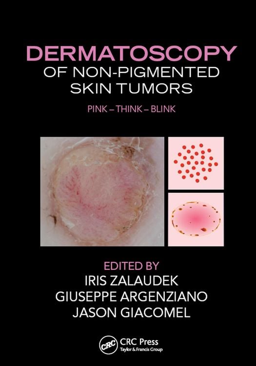 Produktbild: Dermatoscopy of Non-Pigmented Skin Tumors