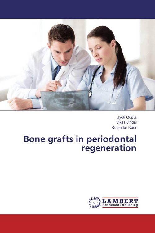 Produktbild: Bone grafts in periodontal regeneration