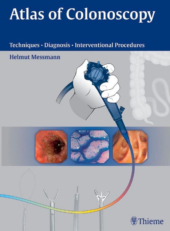 Produktbild: Atlas of Colonoscopy