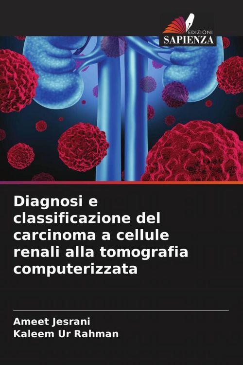 Produktbild: Diagnosi e classificazione del carcinoma a cellule renali alla tomografia computerizzata
