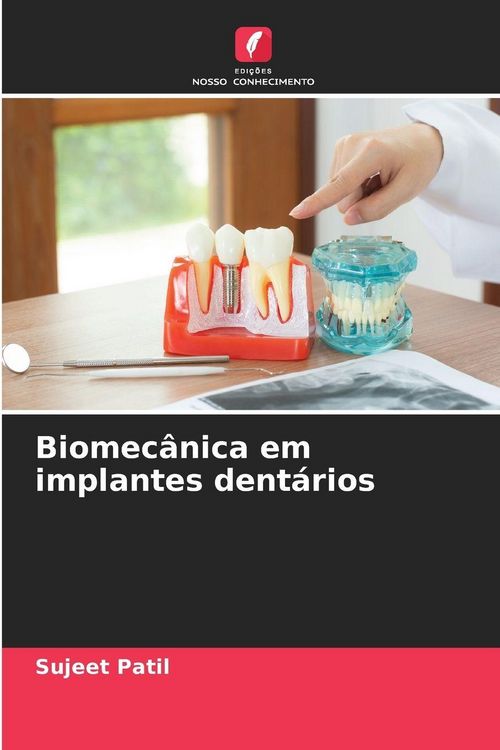 Produktbild: Biomec&acirc;nica em implantes dent&aacute;rios