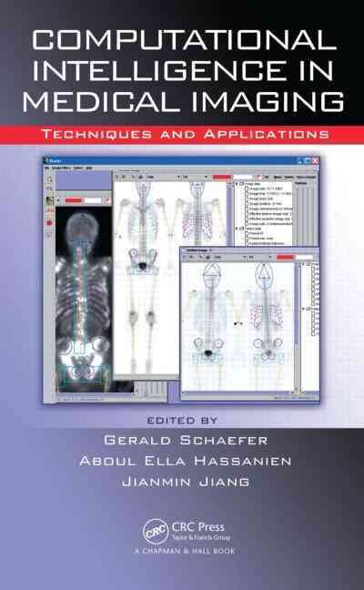Produktbild: Schaefer, G: Computational Intelligence in Medical Imaging