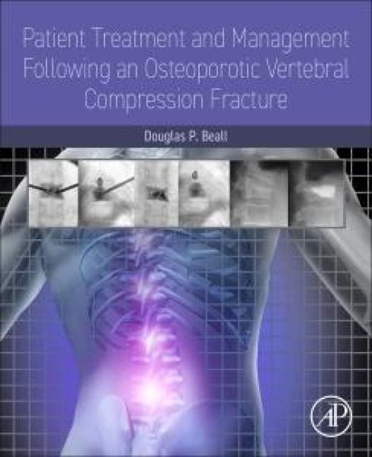 Produktbild: Patient Treatment and Management Following an Osteoporotic Vertebral Compression Fracture