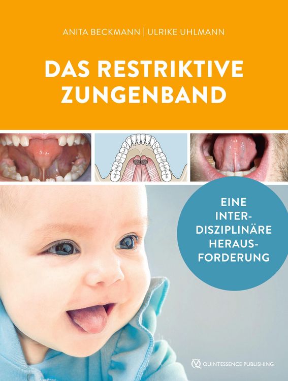 Produktbild: Das restriktive Zungenband