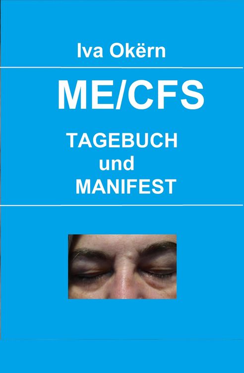 Produktbild: Me/cfs