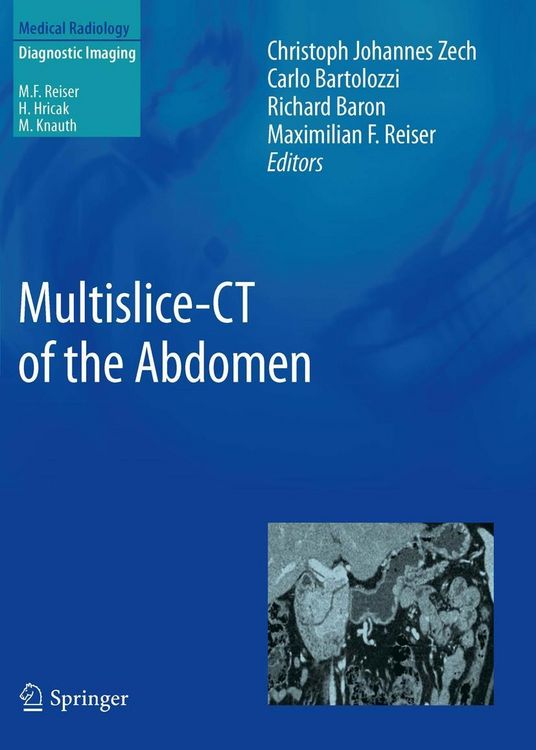 Produktbild: Multislice-CT of the Abdomen