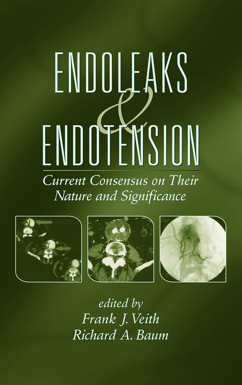 Produktbild: Endoleaks and Endotension