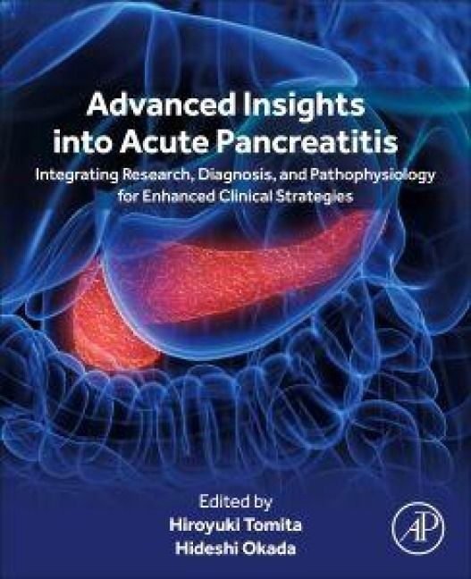 Produktbild: Advanced Insights Into Acute Pancreatitis