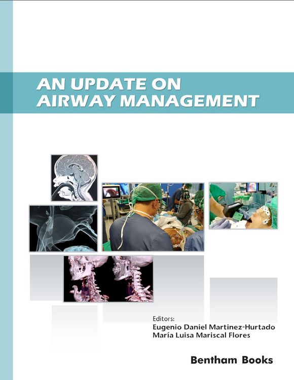 Produktbild: An Update on Airway Management