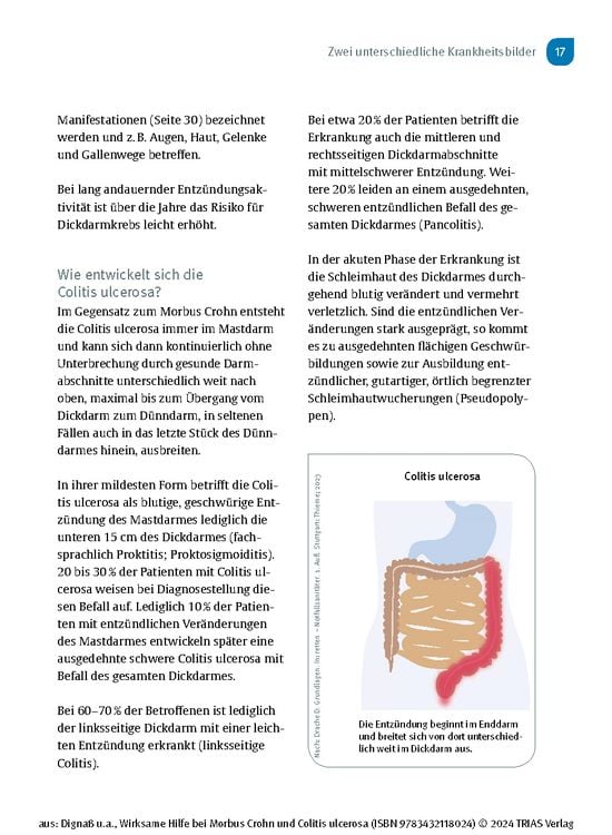 Produktbild: Wirksame Hilfe bei Morbus Crohn und Colitis ulcerosa