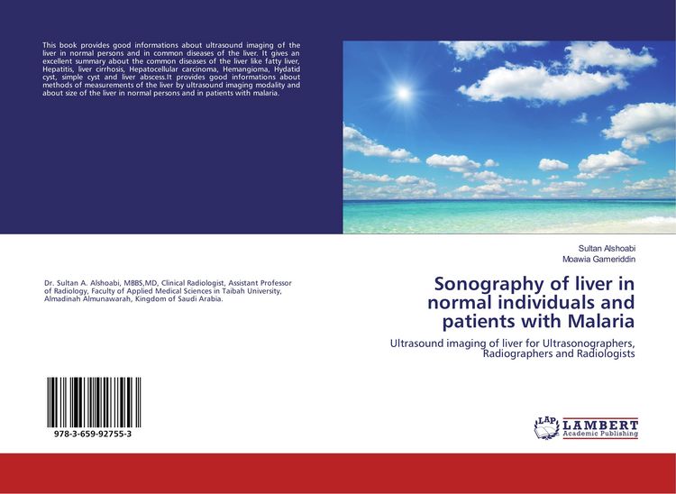 Produktbild: Sonography of liver in normal individuals and patients with Malaria