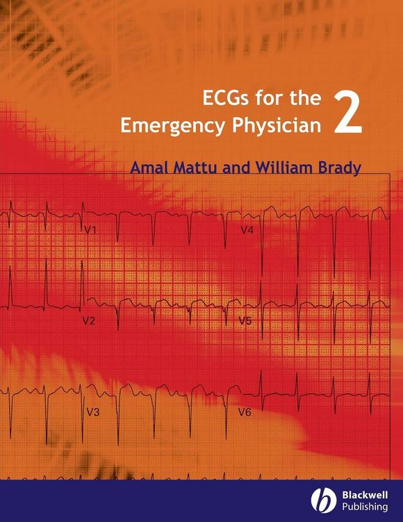 Produktbild: ECGs for the Emergency Physici
