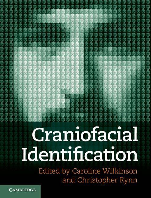 Produktbild: Craniofacial Identification