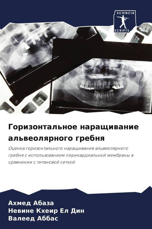 Produktbild: Gorizontal'noe naraschiwanie al'weolqrnogo grebnq