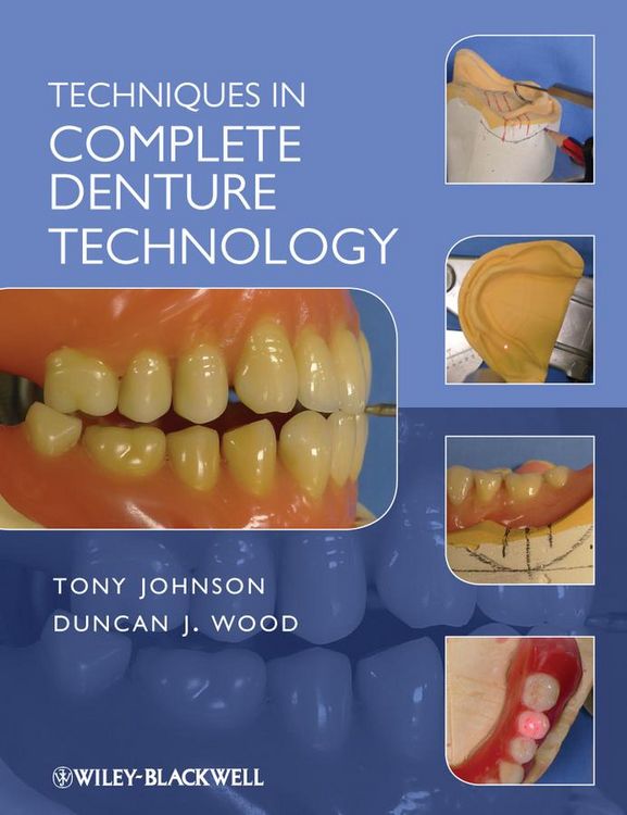 Produktbild: Techniques in Complete Denture Technology