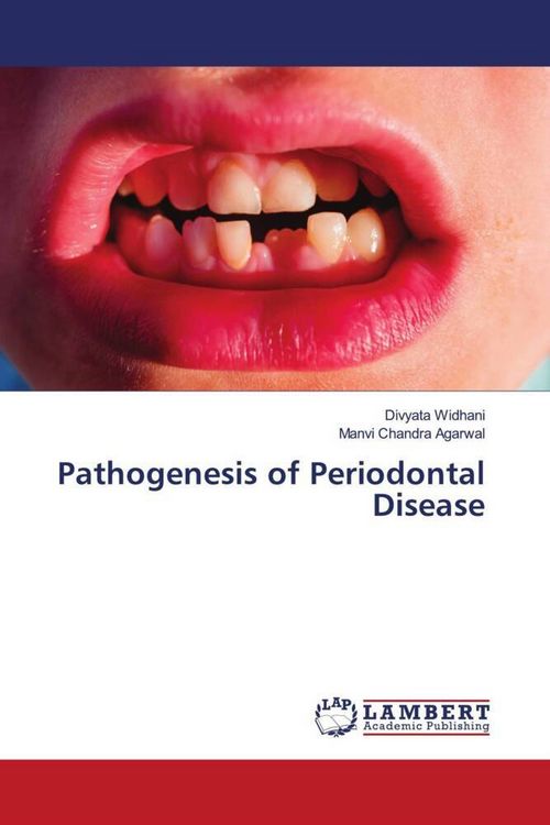 Produktbild: Pathogenesis of Periodontal Disease