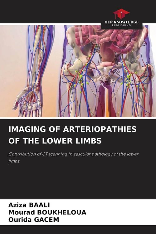 Produktbild: Imaging Of Arteriopathies Of The Lower Limbs