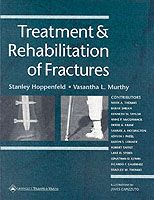 Produktbild: Treatment and Rehabilitation of Fractures