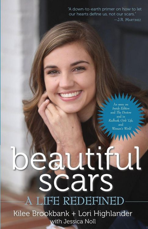 Produktbild: Beautiful Scars