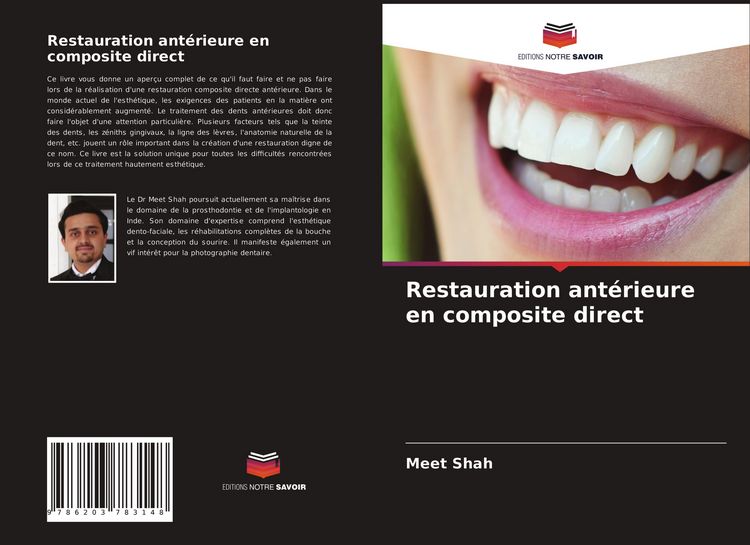 Produktbild: Restauration ant&eacute;rieure en composite direct