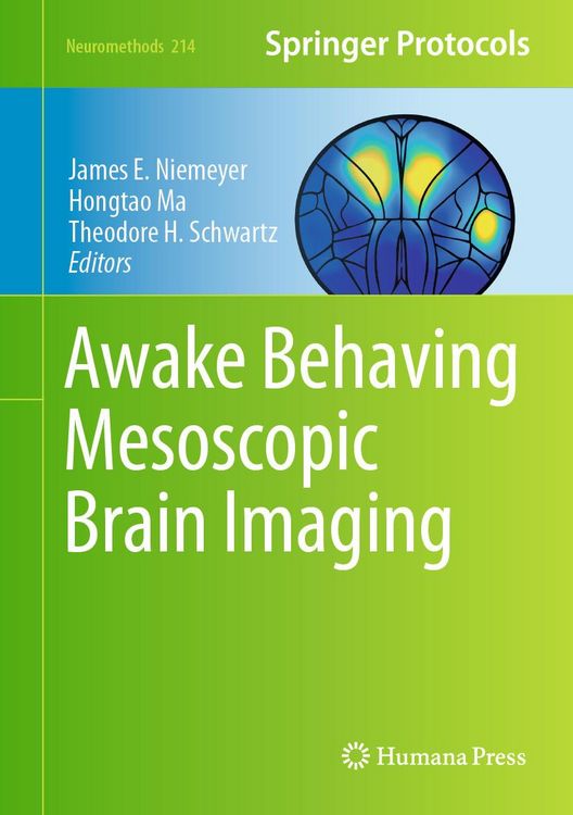 Produktbild: Awake Behaving Mesoscopic Brain Imaging