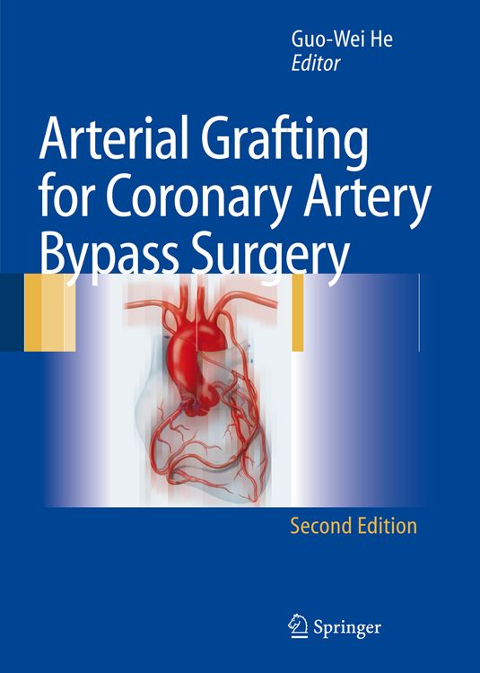 Produktbild: Arterial Grafting for Coronary Artery Bypass Surgery