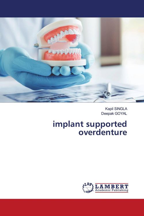 Produktbild: Implant supported overdenture