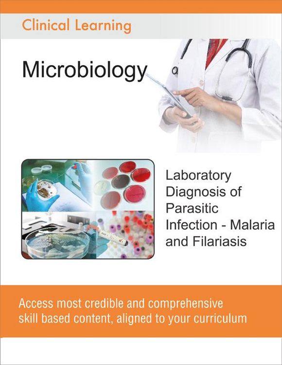 Produktbild: Laboratory Diagnosis of Parasitic Infection - Malaria and Filariasis