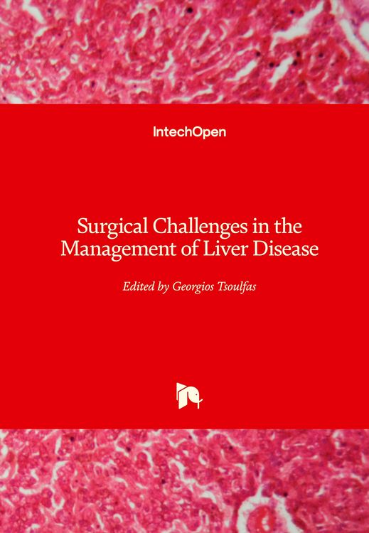 Produktbild: Surgical Challenges in the Management of Liver Disease