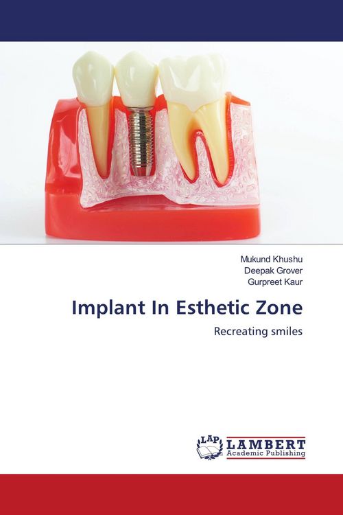 Produktbild: Implant In Esthetic Zone