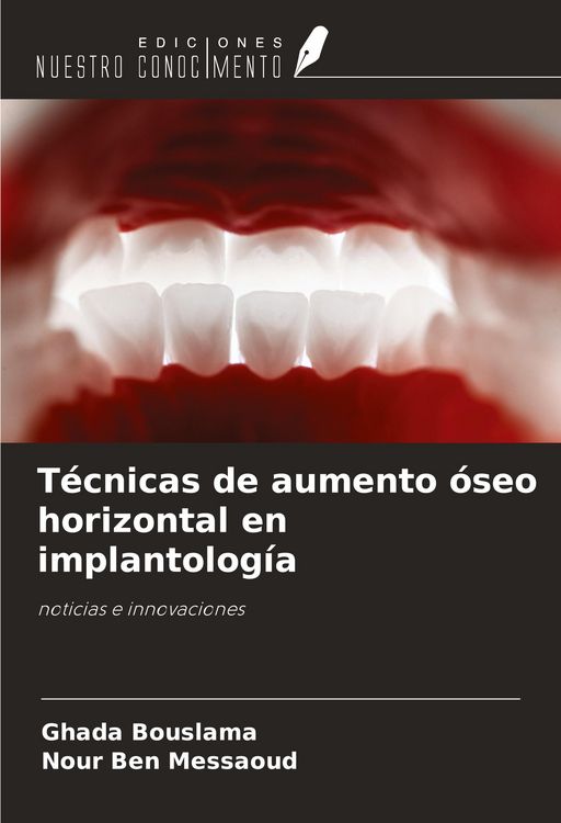 Produktbild: T&eacute;cnicas de aumento &oacute;seo horizontal en implantolog&iacute;a