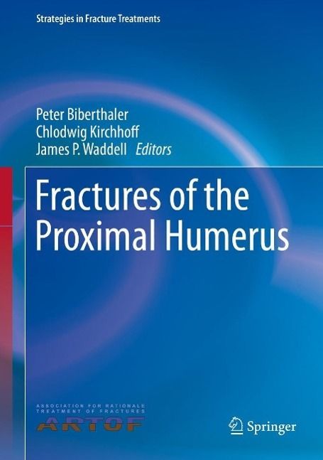 Produktbild: Fractures of the Proximal Humerus