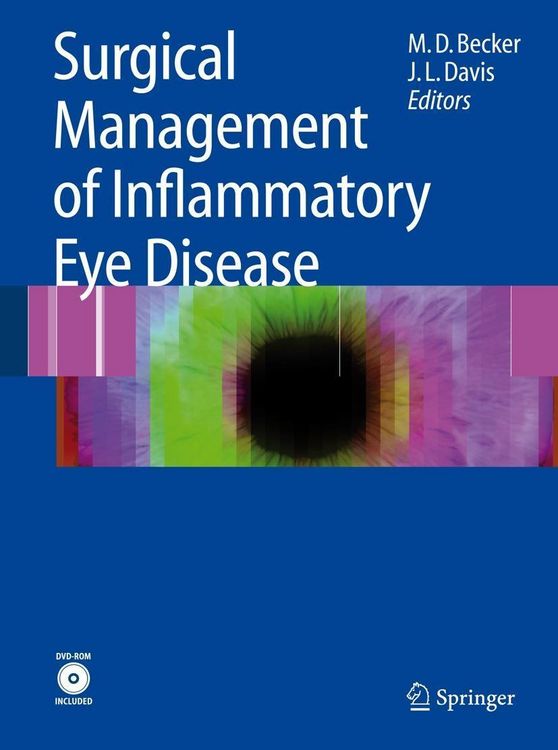Produktbild: Surgical Management of Inflammatory Eye Disease