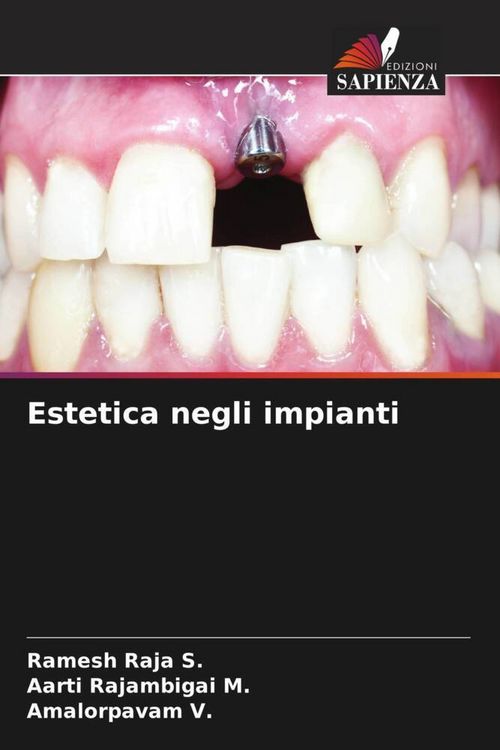 Produktbild: Estetica negli impianti