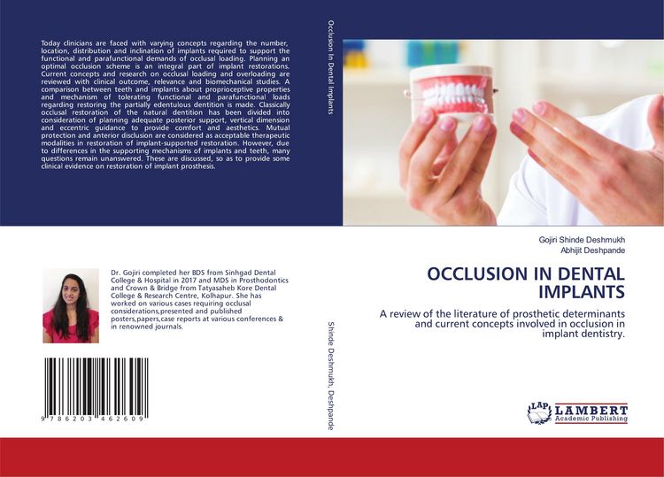 Produktbild: Occlusion in Dental Implants