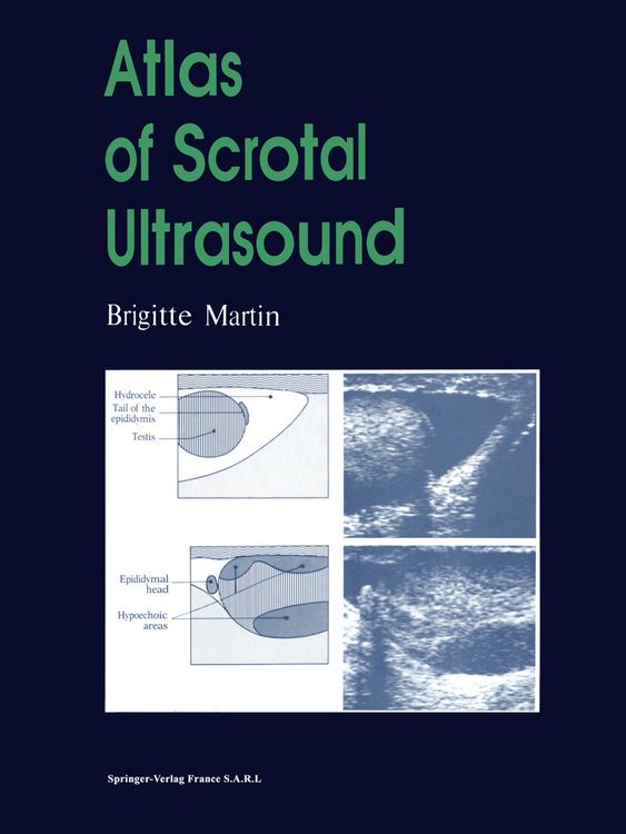 Produktbild: Atlas of Scrotal Ultrasound