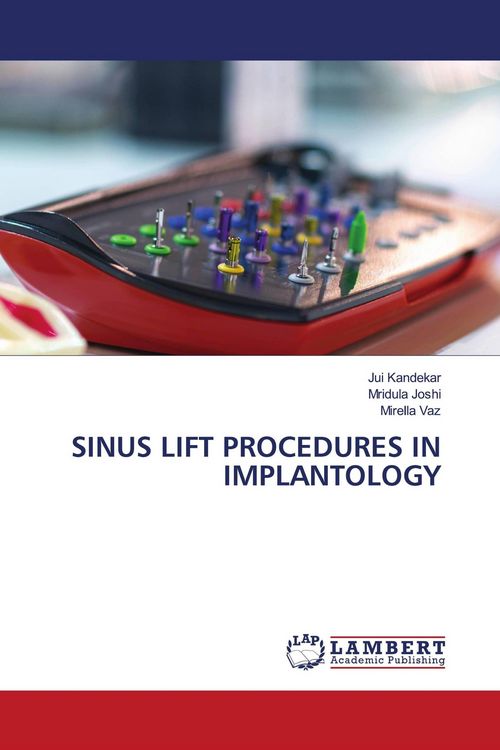 Produktbild: Sinus Lift Procedures in Implantology